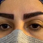 معرفی کلینیک ارتوپدی و خدماتی آن کاشت ابرو